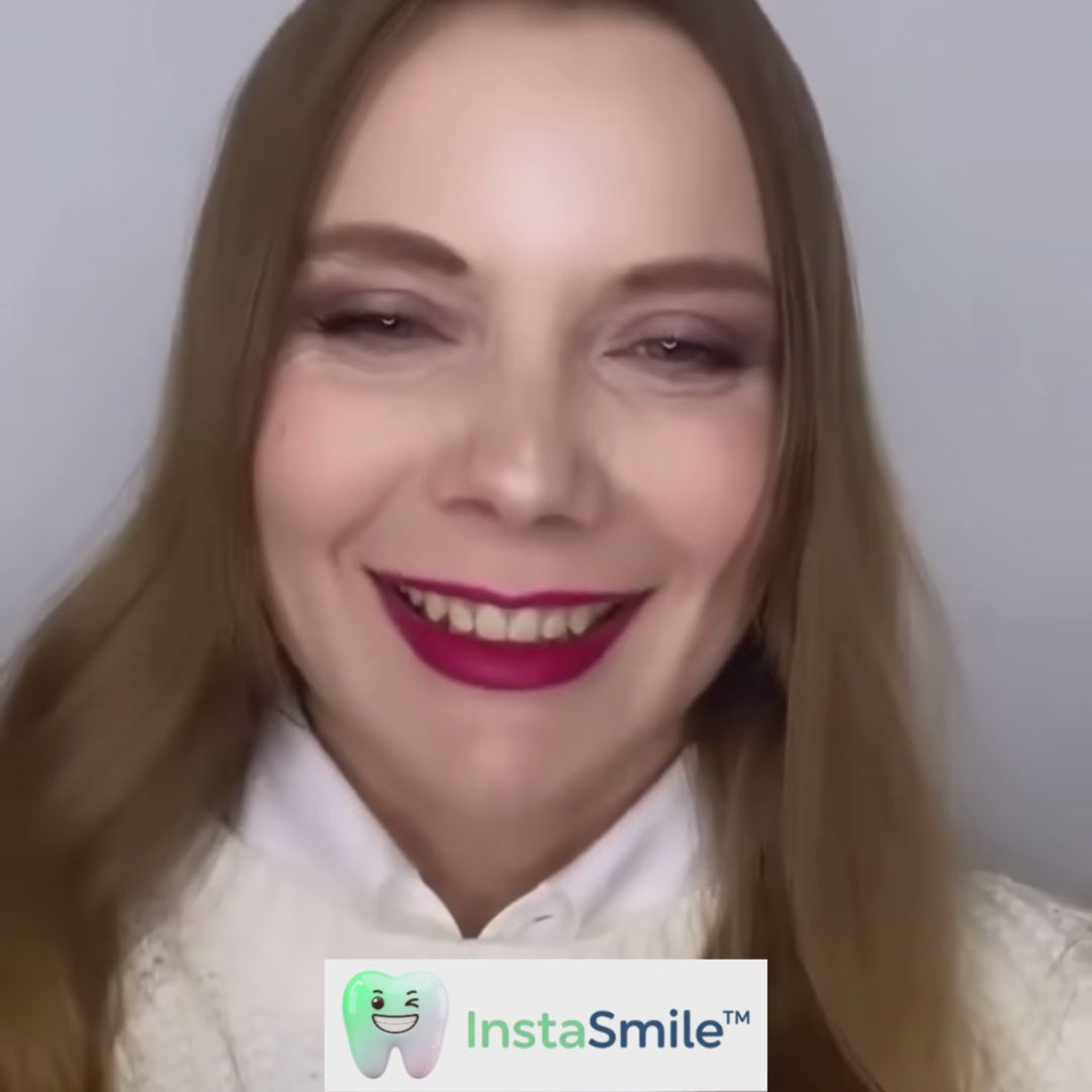 InstaSmile™ Carillas Dentales a Presión Moldeables